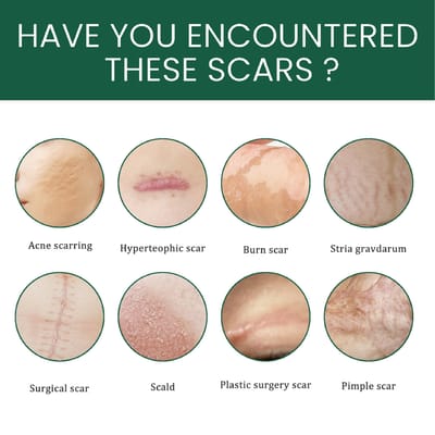 Silicone Gel Scar Patch Roll – Adjustable, Effective Scar Treatment_img_8