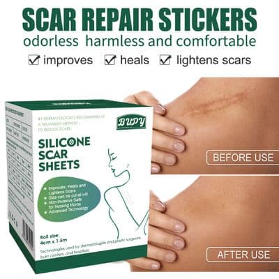 Silicone Gel Scar Patch Roll – Adjustable, Effective Scar Treatment_img_1