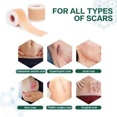 Silicone Gel Scar Patch Roll – Adjustable, Effective Scar Treatment_img_2