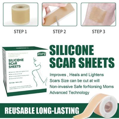 Silicone Gel Scar Patch Roll – Adjustable, Effective Scar Treatment_img_6