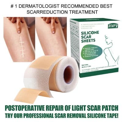 Silicone Gel Scar Patch Roll – Adjustable, Effective Scar Treatment_img_4