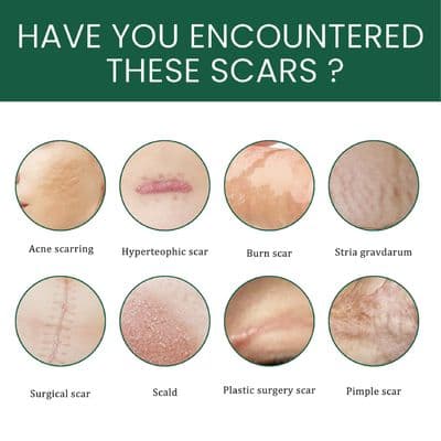 Silicone Gel Scar Patch Roll – Adjustable, Effective Scar Treatment_img_8